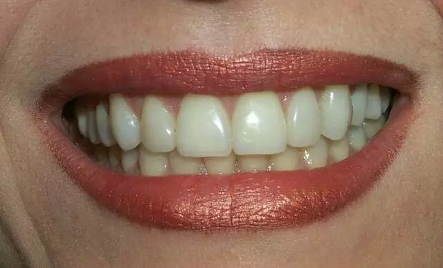 Radiant Smiles