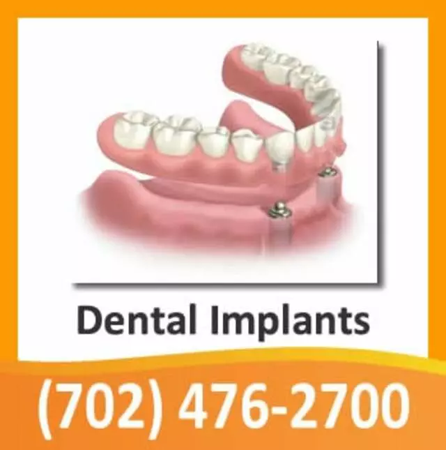 Advanced Dentistry