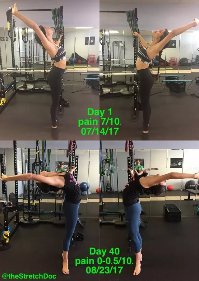The Stretch Doc