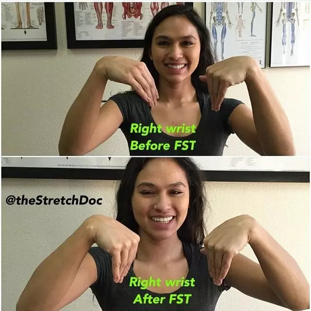 The Stretch Doc