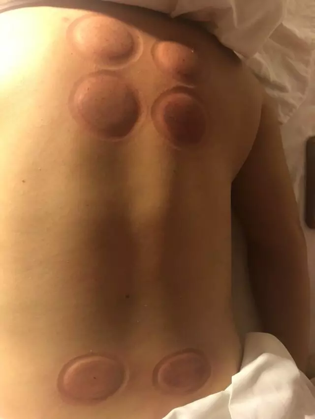Angel’s Healing