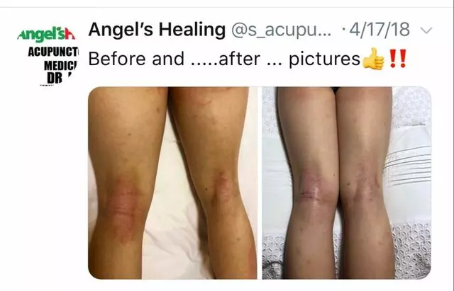 Angel’s Healing
