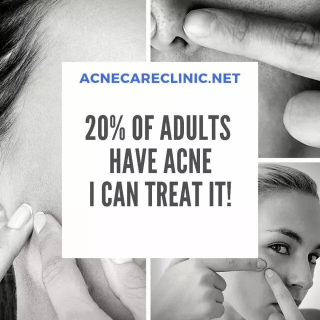 Acne Care Clinic