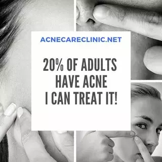 Acne Care Clinic
