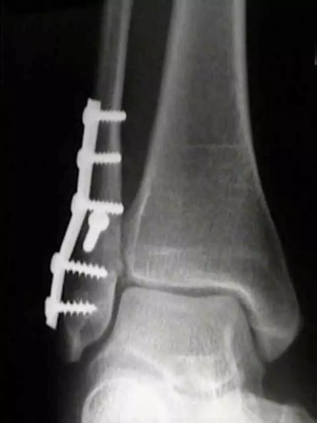 Apache Foot & Ankle Specialists