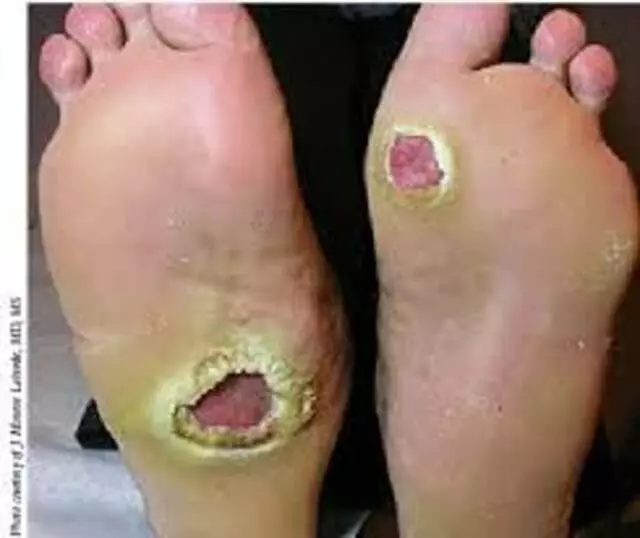 Apache Foot & Ankle Specialists