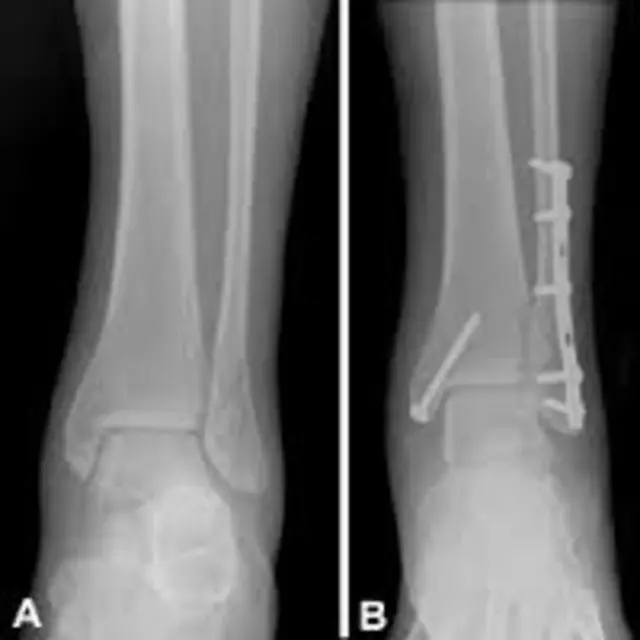 Apache Foot & Ankle Specialists