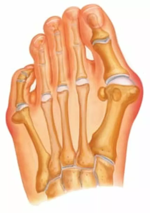 Apache Foot & Ankle Specialists