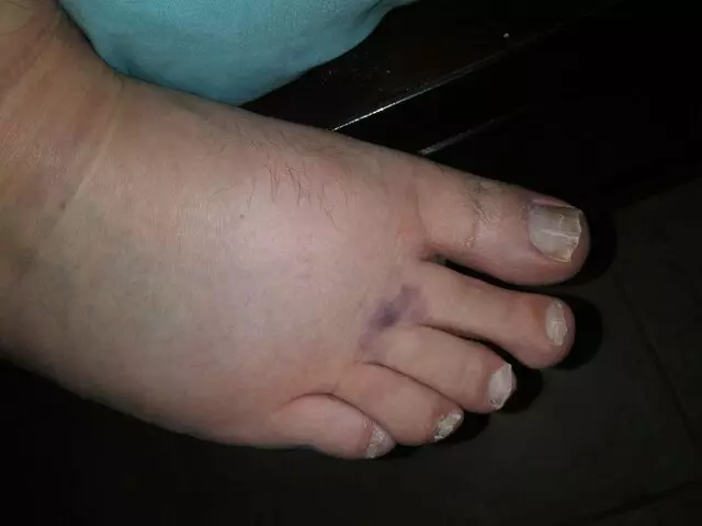Holper Steven A MD
