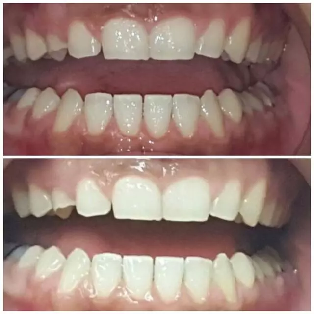Amazing White Smile Studio