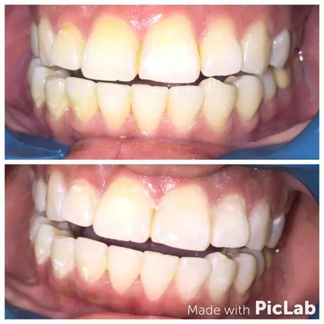 Amazing White Smile Studio