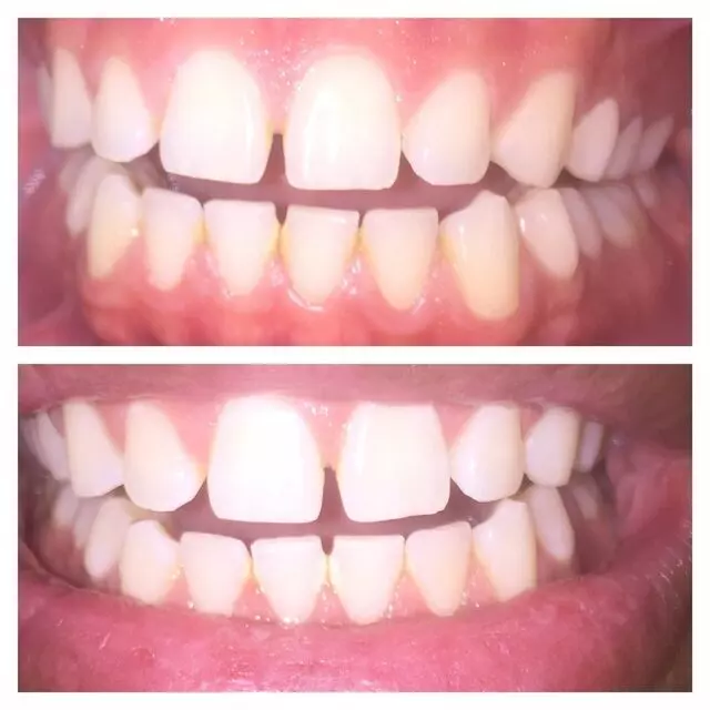 Amazing White Smile Studio