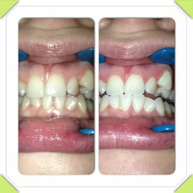 Amazing White Smile Studio