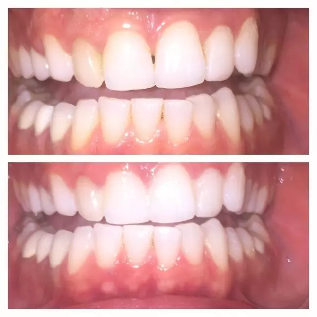 Amazing White Smile Studio