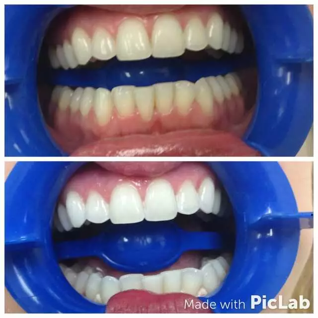 Amazing White Smile Studio