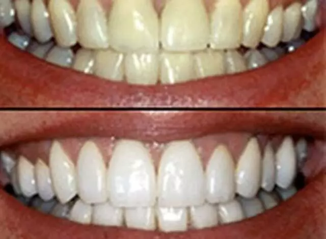 Amazing White Smile Studio