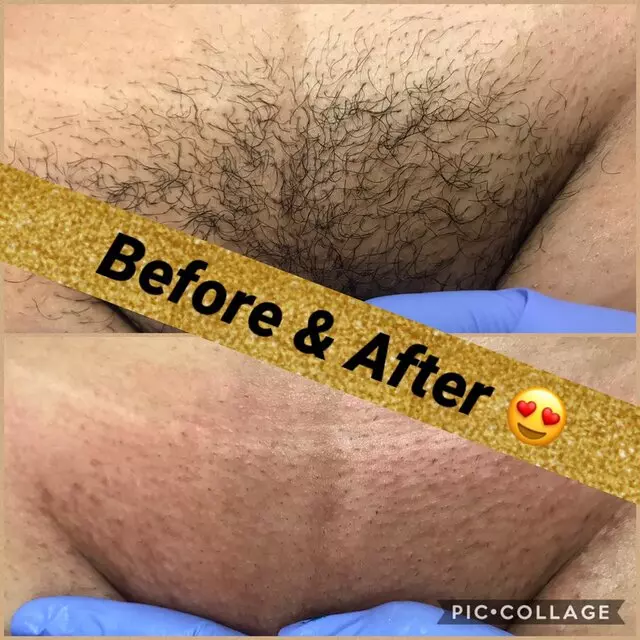 A Rich Treatments
