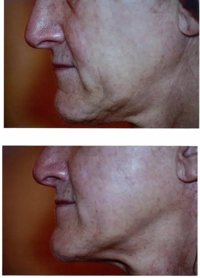 All About Skin Laser Center