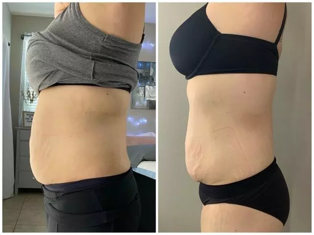 Edge Body Sculpting