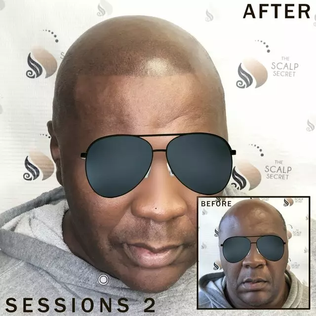 The Scalp Secret