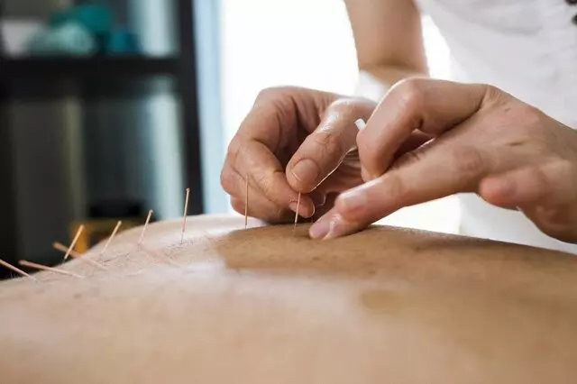 Integrative Acupuncture - Las Vegas