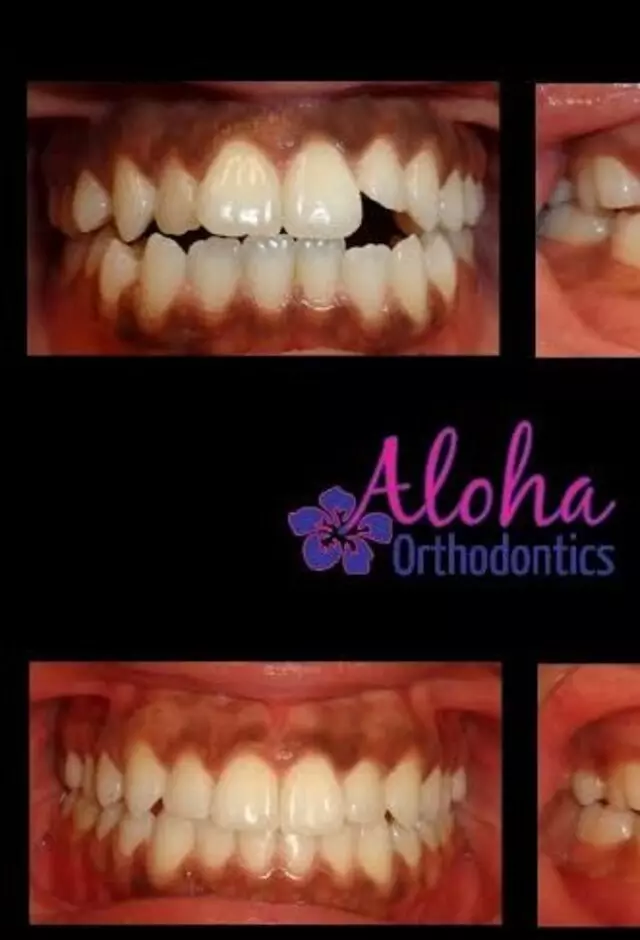 Aloha Orthodontics