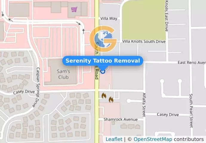 Serenity Tattoo Removal
